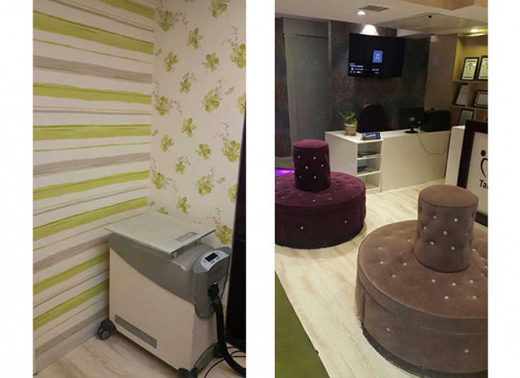 لیزر الکس سایناشور در کلینیک تندیس