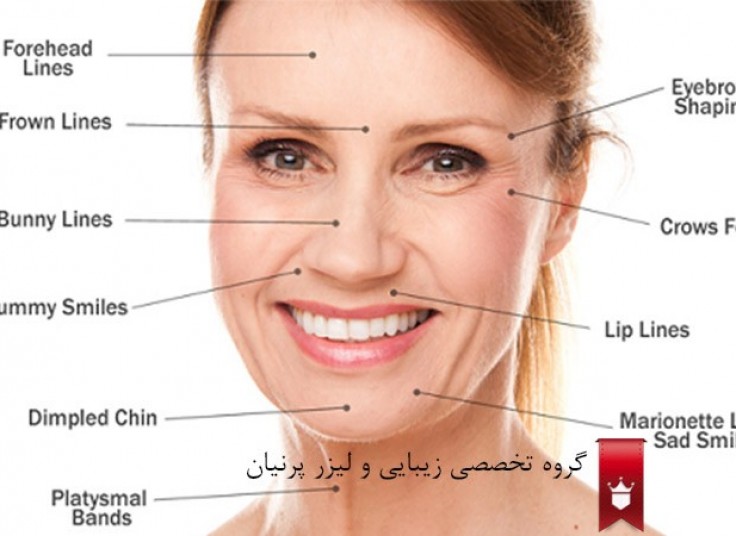 تزریق بوتاکس کلینیک پرنیان