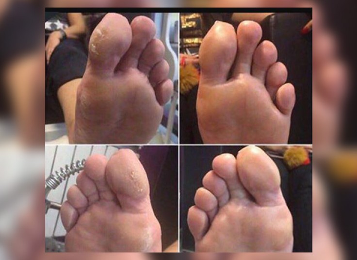 پارافین تراپی در سالن چهره نگاران