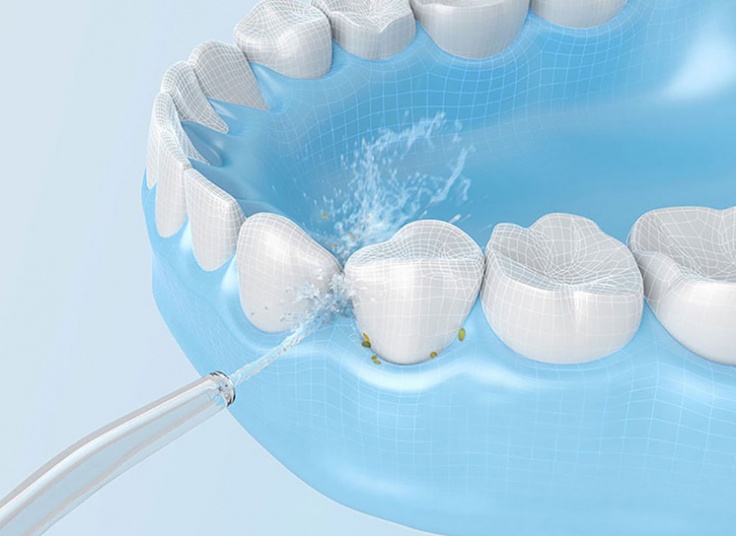 واتر جت شستشوی دهان و دندان شیائومی Mijia