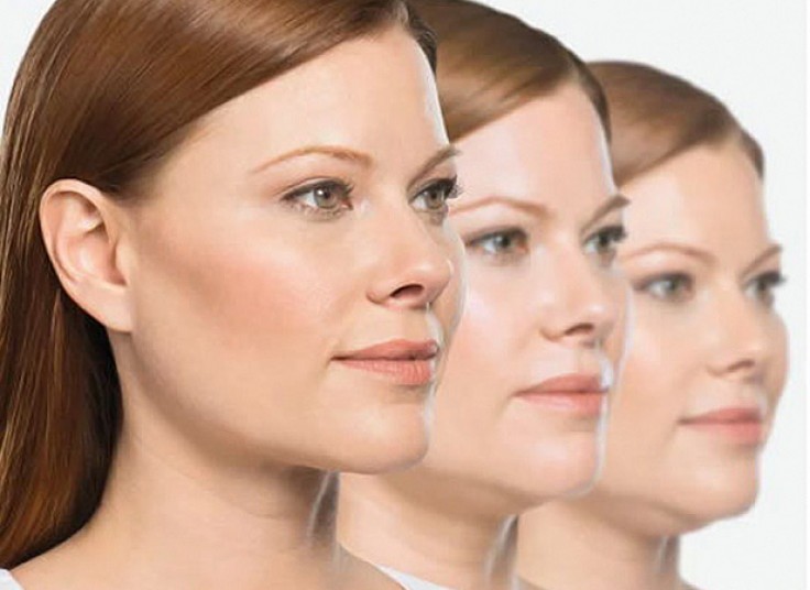 لاغری با دستگاه RF در مرکز پوست مو لاغری سیب