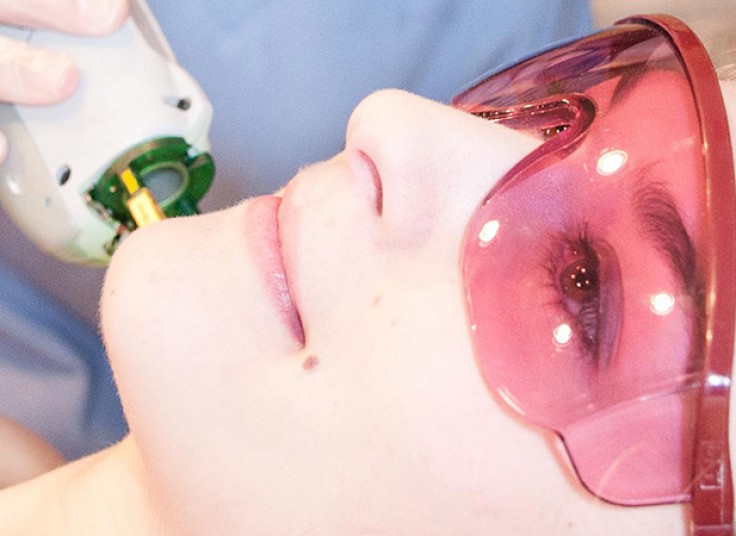 لیزر SHR در مرکز پوست تبسم