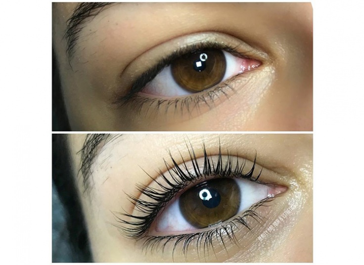 لیفت و لمینت در سالن پرجان