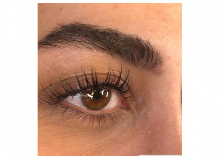 لیفت و لمینت در سالن رز طلایی