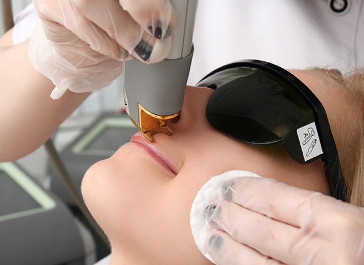 لیزر دایود در مطب دکتر شیده بابانژاد