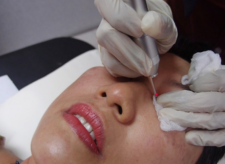 آکنه تراپی و درمان کامل جوش در مطب صبا