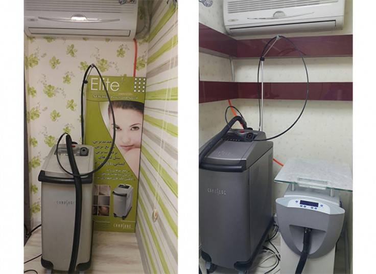 لیزر الکس سایناشور در کلینیک تندیس