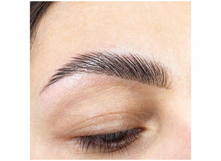 لیفت و لمینت در سالن پرجان