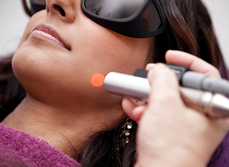 لیزر دایود مرکز هیرلس