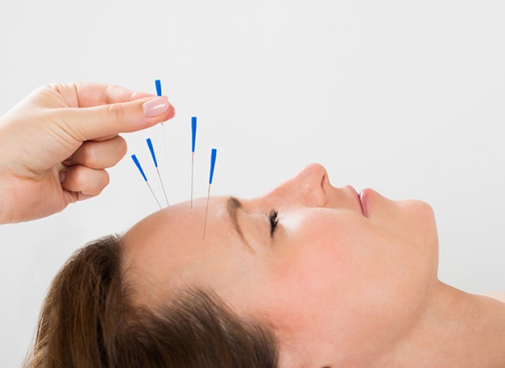 طب سوزنی مطب شرقی