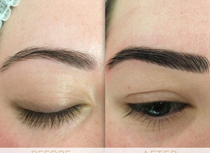 میکروپیگمنتیشن سالن الیا