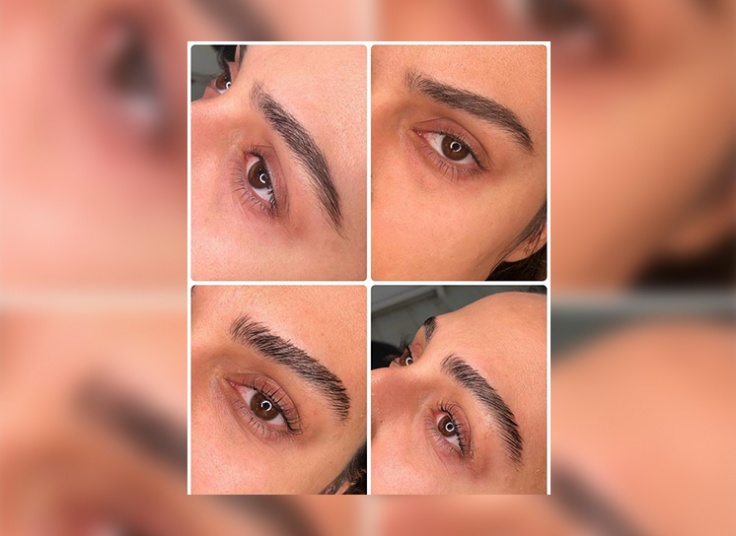 لیفت و لمینت در سالن پرجان