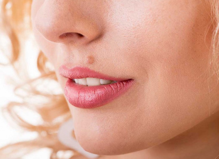 خالبرداری با دستگاه RF دکتر شمسی نژاد