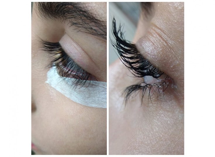 لیفت و لمینت در سالن پرجان