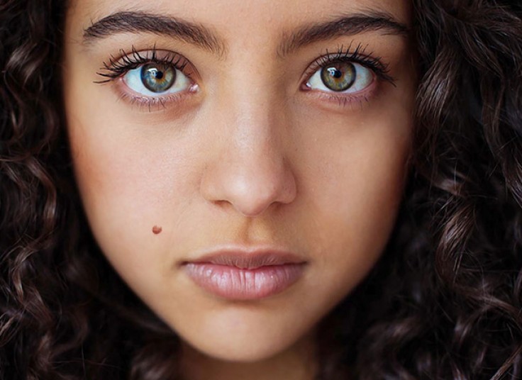 خالبرداری در کلینیک مهر باران