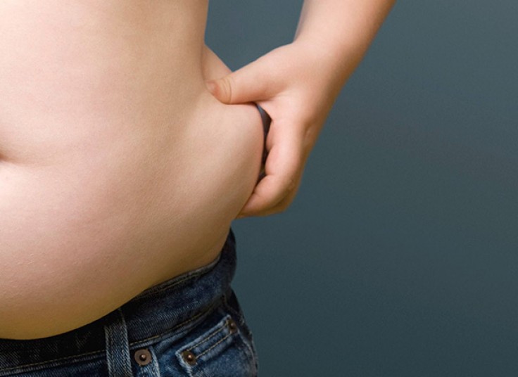 کرایولیپولیز مرکز سیب سرخ میرداماد