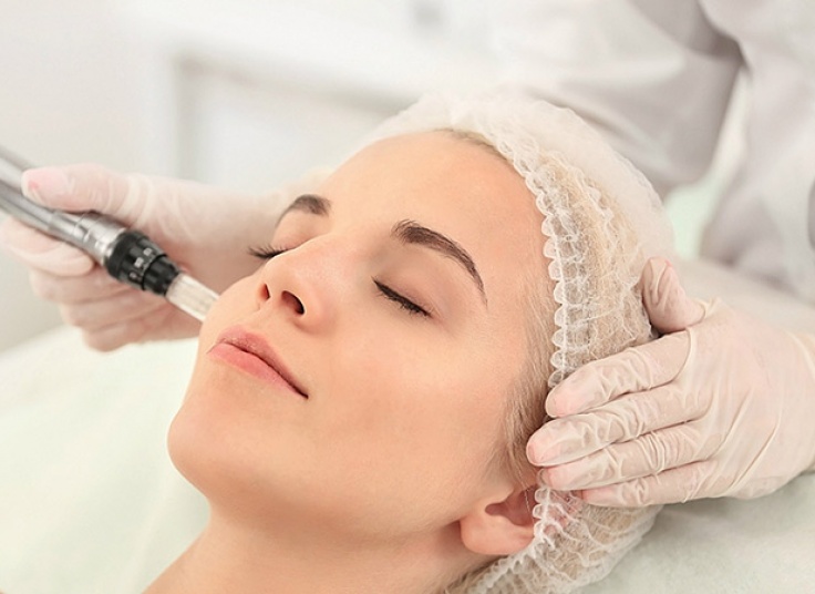 میکرونیدلینگ مطب شرقی