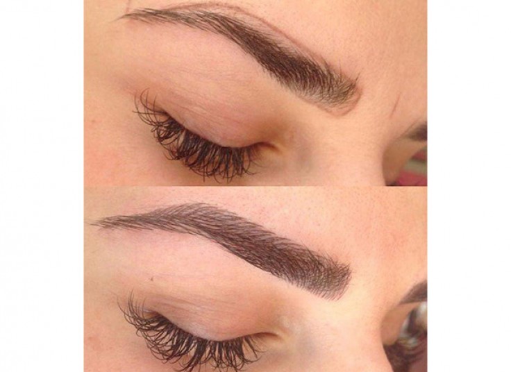 میکروپیگمنتیشن سالن نیلای