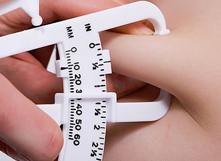 کرایولیپولیز در مطب دکتر مطلبی