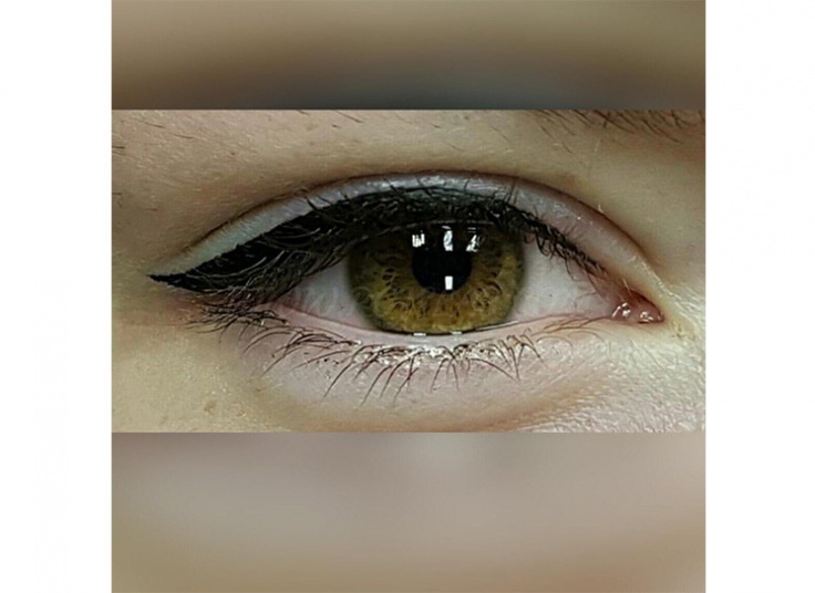 میکروپیگمنتیشن سالن نیلای