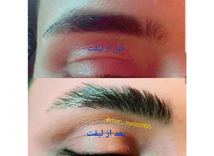 لیفت و لمینت در سالن رز طلایی