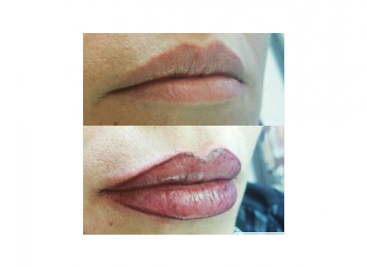 میکروپیگمنتیشن سحر