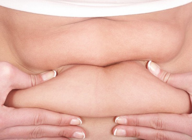 کرایولیپولیز کلینیک دکتر دهباشی