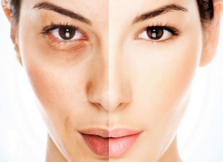 لیزر روشن سازی بدن در مرکز سیدخندان