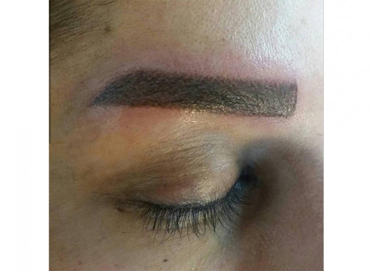 میکروپیگمنتیشن سحر