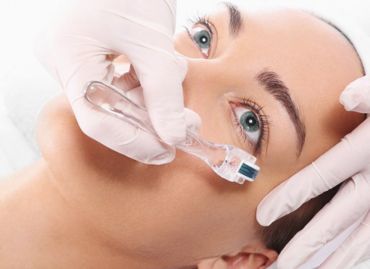 میکرونیدلینگ کلینیک مهراد