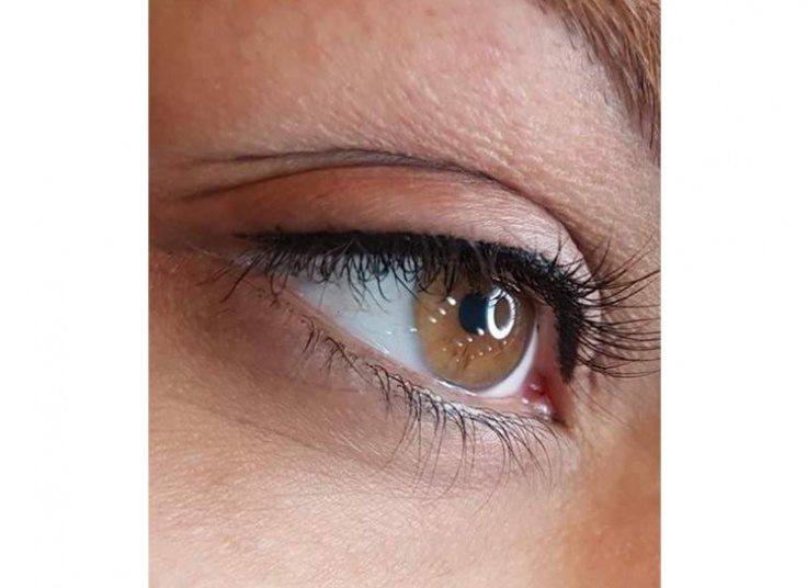 میکروپیگمنتیشن سالن لیانا