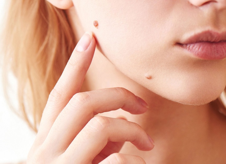 خالبرداری کلینیک یاس