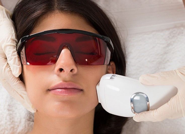 لیزر SHR هیرلس